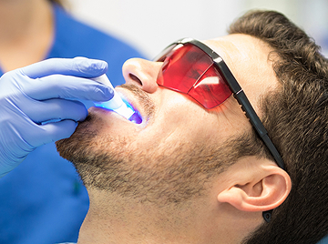 Zoom Teeth Whitening: An Excellent Remedy For Discolored Teeth