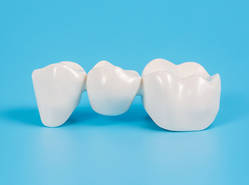 Dental Bridges: What Are They And Are They An Ideal Solution For Missing Teeth?