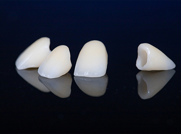 How Dental Crowns Can Save Your Teeth